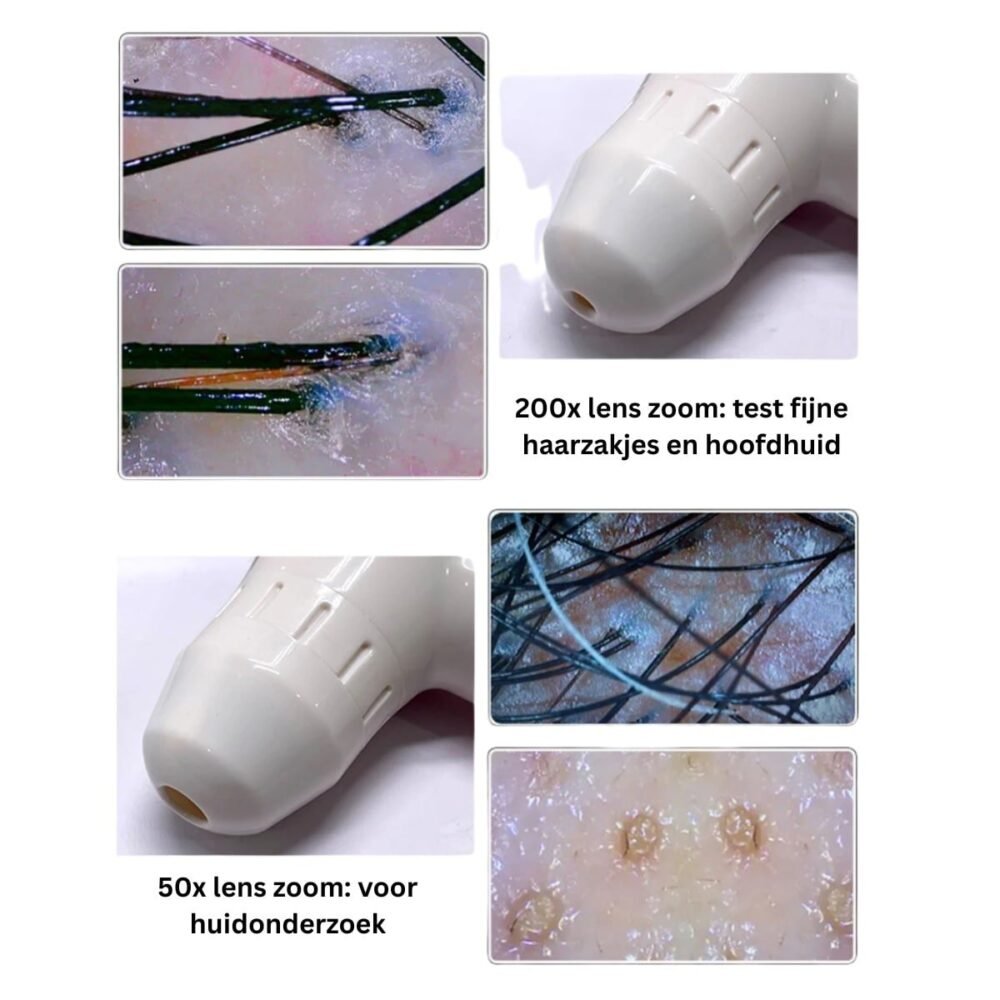 Hoofdhuid Analyse Apparaat