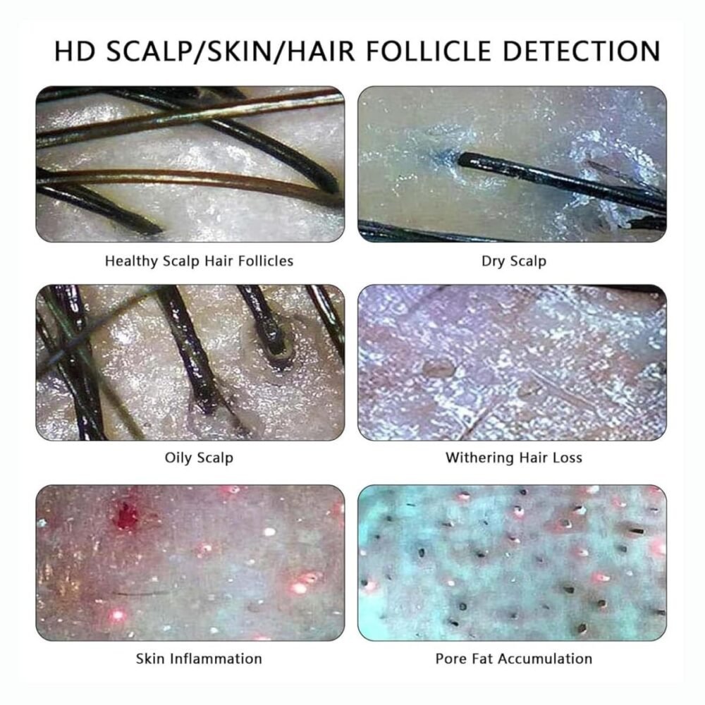 Headspastore scalp and skin analyser device