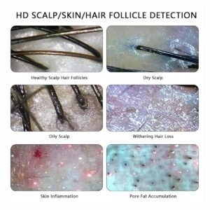 Headspastore scalp and skin analyser device