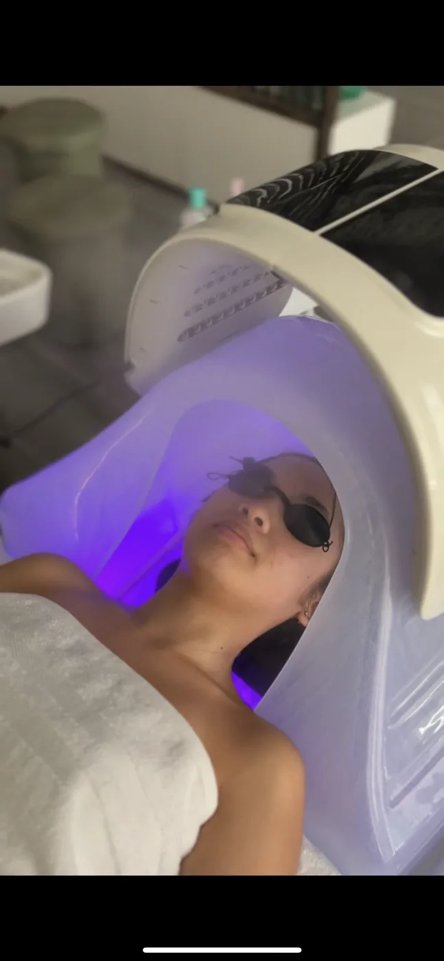 Customer photo, verified head spa buyer, Canada